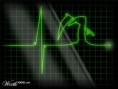 /album/fotogalerie/ekg-jpg/